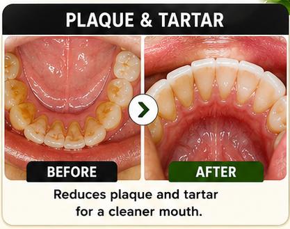 Plaque and Tartar Before and After